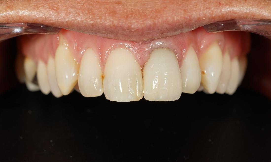 Teeth