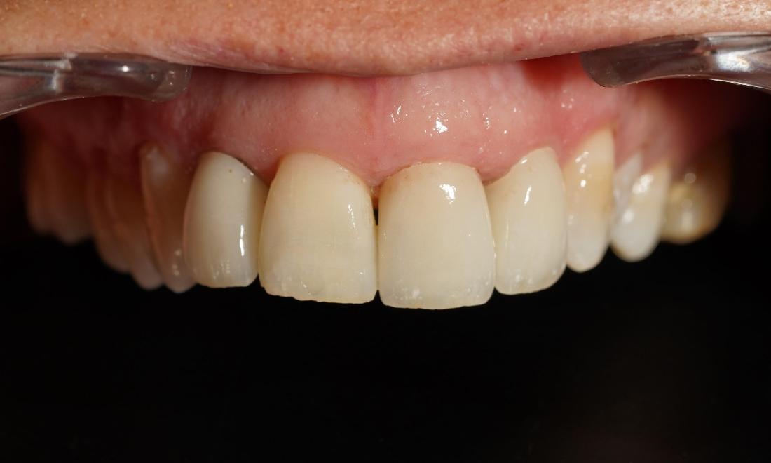 Teeth