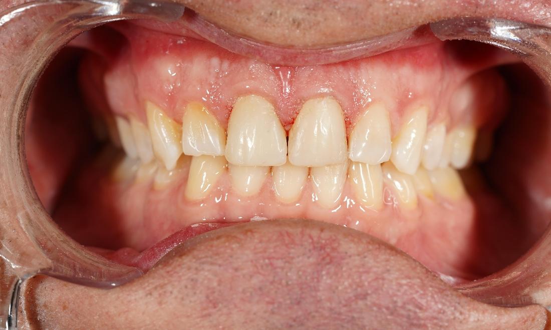 Teeth