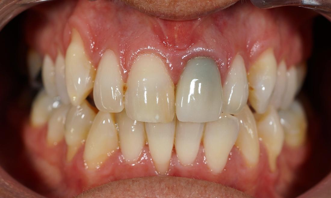 Teeth