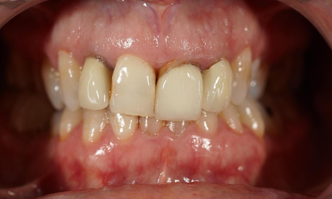 Teeth
