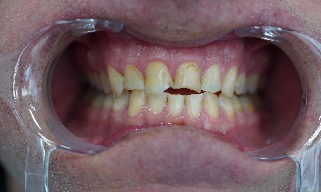 Teeth